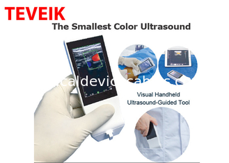 Ponta de prova sem fio portátil do ultrassom de Android da máquina médica do ultrassom de Wifi linear